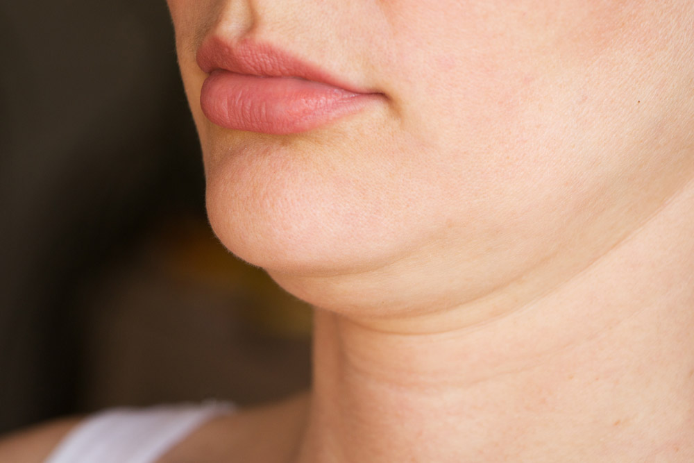 Double Chin fat freeze Singapore