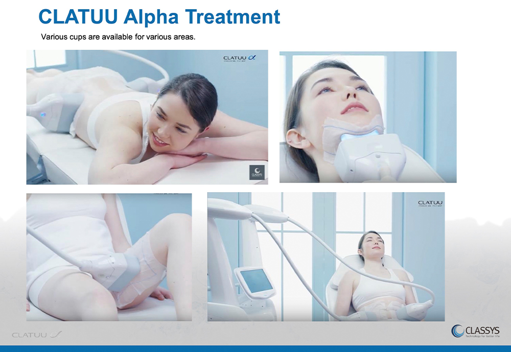 Various cooling cups fat freezing Singapore