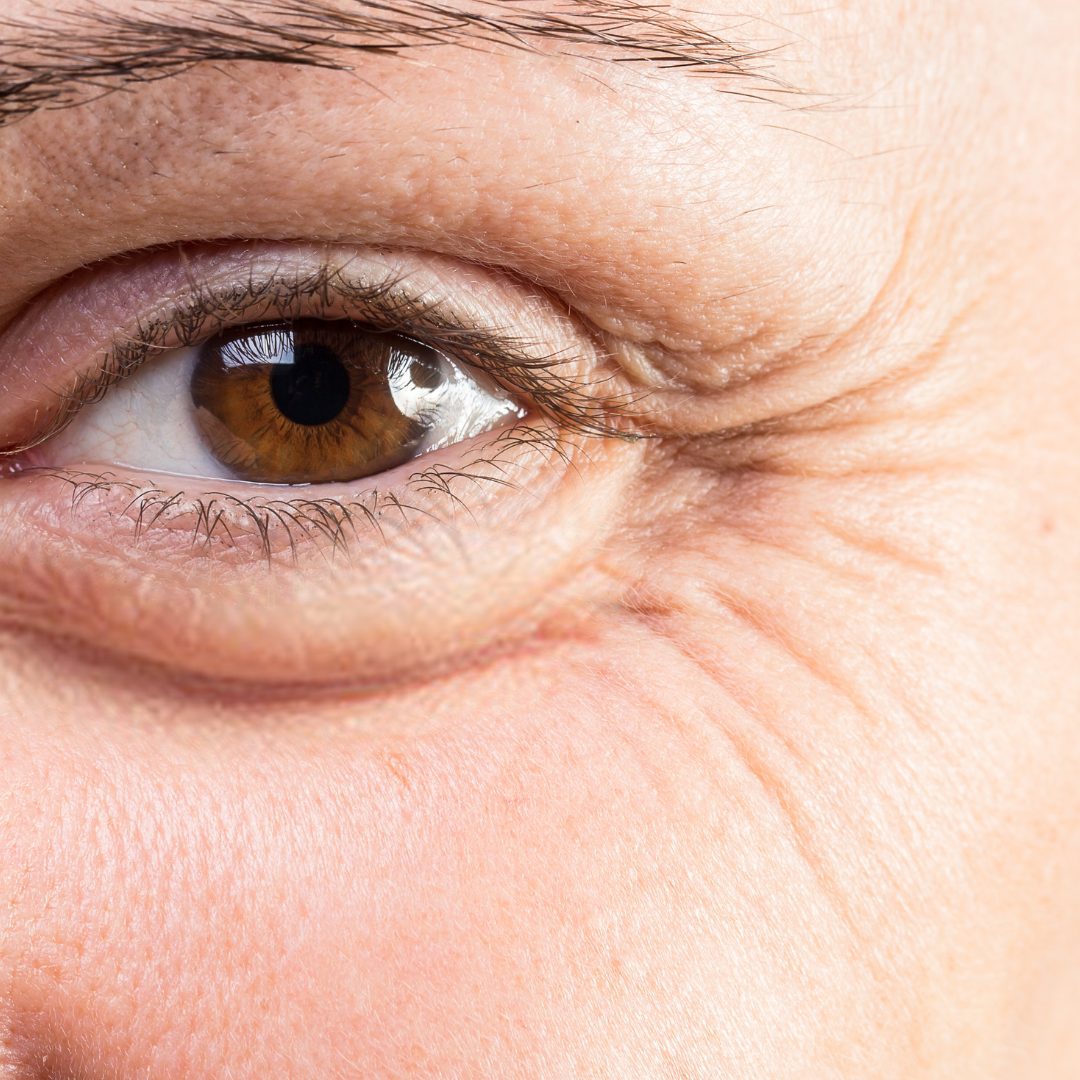 Close up of fine lines and crow's feet around eyes